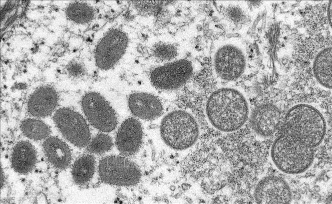 Electron microscopic image of monkeypox virus. (Photo: AFP/VNA)